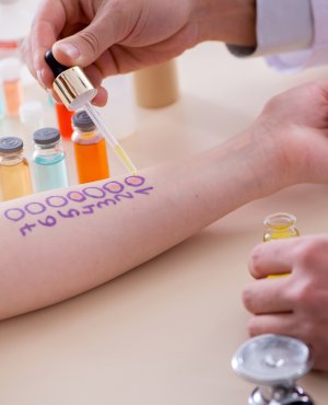 Allergy Testing Doctor in River Oaks, TX