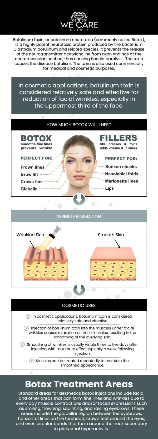 Botox is a non-surgical injectable treatment that smooths fine lines and wrinkles by relaxing specific facial muscles. At We Care Clinic in River Oaks, TX, Board-certified Dr. Shabnam Qasim, MD, along with our experienced nurse practitioners, provide tailored Botox treatments to help you achieve natural, refreshed results. With minimal downtime and lasting effects, Botox is a convenient solution for maintaining a youthful, rejuvenated appearance. For more information, contact us or schedule an appointment online. We are conveniently located at 1011 Roberts Cut Off Rd, River Oaks, TX 76114.